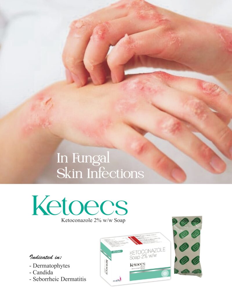 KETOECS